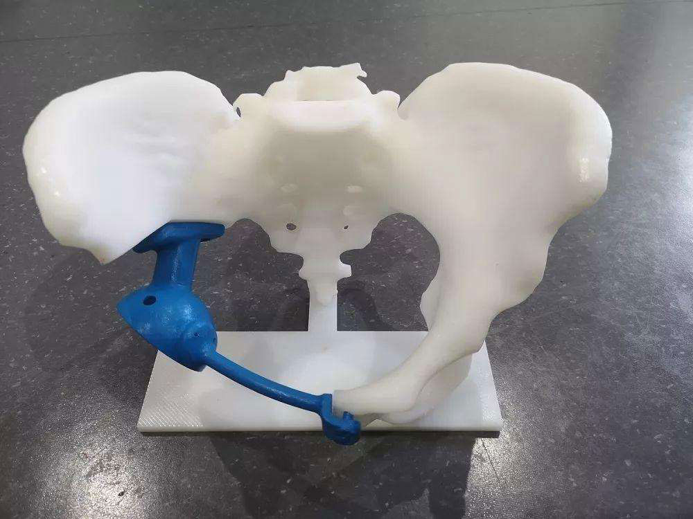 SLA 3D printing